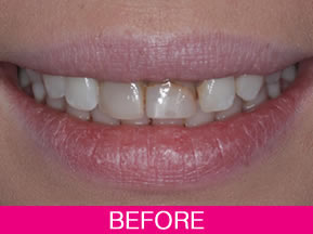 radiant dental chair